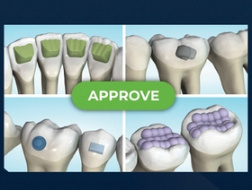 Planification optimale de vos cas d'orthodontie avec aligneurs (Module 5 de 5)