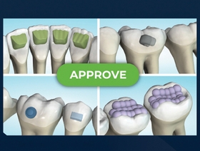 Planification optimale de vos cas d'orthodontie avec aligneurs (Module 5 de 5)