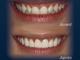 Planification de cas esthétique et dentisterie numérique