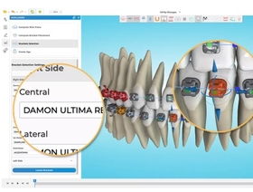 COURS EN LIGNE-“Bootcamp” sur le système orthodontique Ormco Digital Bonding (ODB)