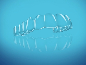 L'orthodontie avec aligneurs