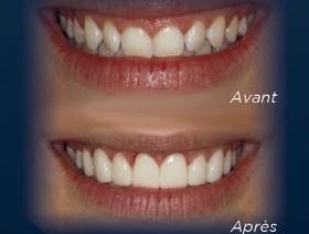 Intégration efficace d'un département de prosthodontie et « workflow » numérique
