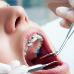 7 raisons de se former en orthodontie et orthopédie dentofaciale