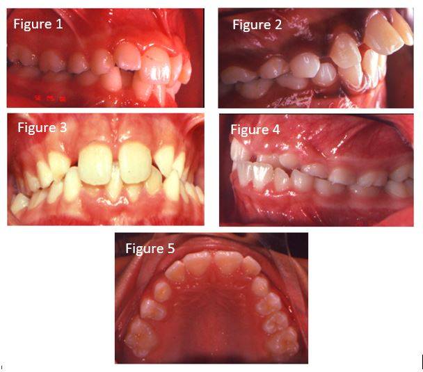 Classification